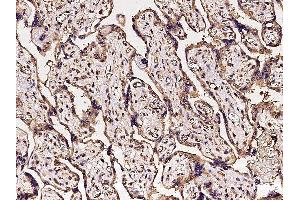 Image no. 3 for anti-Carbonic Anhydrase VB, Mitochondrial (CA5B) (AA 34-317) antibody (ABIN2213158)