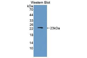 Image no. 2 for anti-Disrupted in Schizophrenia 1 (DISC1) (AA 151-330) antibody (ABIN5013464)