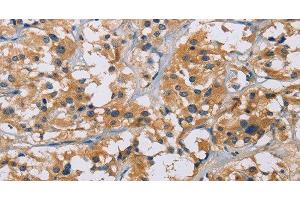 NME5 antibody