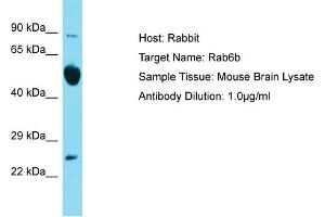 Image no. 1 for anti-RAB6B, Member RAS Oncogene Family (RAB6B) (C-Term) antibody (ABIN2790371)
