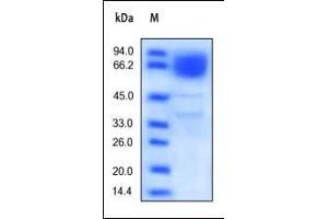 Image no. 1 for CD36 (CD36) (AA 30-439) protein (His tag) (ABIN2180762)