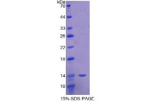 Image no. 1 for Sema Domain, Immunoglobulin Domain (Ig), Short Basic Domain, Secreted, (Semaphorin) 3E (SEMA3E) (AA 581-669) protein (His tag) (ABIN1080786)