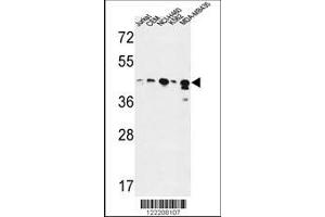anti-Alcohol Dehydrogenase 7 (Class IV), mu Or sigma Polypeptide (ADH7) (AA 318-346), (C-Term) antibody
