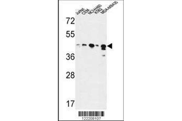 anti-Alcohol Dehydrogenase 7 (Class IV), mu Or sigma Polypeptide (ADH7) (AA 318-346), (C-Term) antibody
