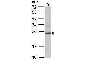 Image no. 1 for anti-Proteasome (Prosome, Macropain) Subunit, beta Type, 8 (Large Multifunctional Peptidase 7) (PSMB8) (Center) antibody (ABIN2856915)