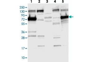 Image no. 2 for anti-Synaptotagmin Like Protein 1 (SYTL1) antibody (ABIN5589116)