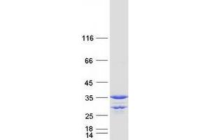 Image no. 1 for Methylmalonic Aciduria (Cobalamin Deficiency) CblC Type, with Homocystinuria (MMACHC) protein (Myc-DYKDDDDK Tag) (ABIN2726131)