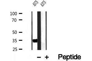 Image no. 2 for anti-Dehydrogenase/reductase (SDR Family) Member 3 (DHRS3) (Internal Region) antibody (ABIN6261290)