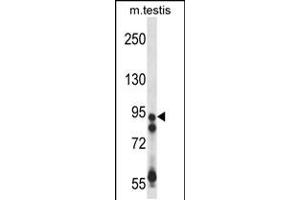 Image no. 2 for anti-Ubiquitin Specific Peptidase 20 (USP20) (AA 310-339) antibody (ABIN5534787)