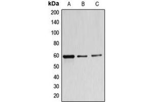 Image no. 1 for anti-beta-1,4-N-Acetyl-Galactosaminyl Transferase 1 (B4GALNT1) (Center) antibody (ABIN2705557)