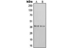 Image no. 2 for anti-Purinergic Receptor P2Y, G-Protein Coupled, 14 (P2RY14) (Center) antibody (ABIN2706253)