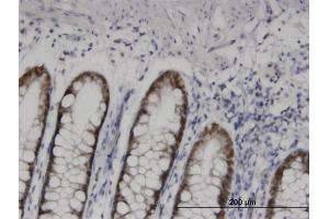 Image no. 5 for anti-Homeobox D11 (HOXD11) (AA 1-76) antibody (ABIN561358)