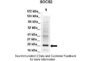 Image no. 1 for anti-Suppressor of Cytokine Signaling 2 (SOCS2) (C-Term) antibody (ABIN2789498)