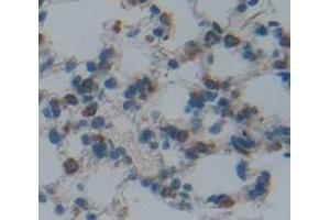 Image no. 2 for anti-Upregulator of Cell Proliferation (URGCP) (AA 689-924) antibody (ABIN1872144)