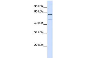 Image no. 1 for anti-Methyltransferase Like 16 (METTL16) (N-Term) antibody (ABIN2783082)