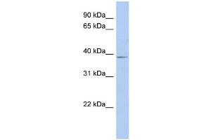 Image no. 1 for anti-Solute Carrier Family 25, Member 28 (SLC25A28) (Middle Region) antibody (ABIN2781695)