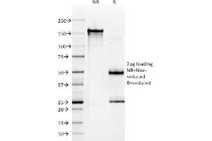 Image no. 1 for anti-Major Histocompatibility Complex, Class I, A (HLA-A) antibody (ABIN6939619)