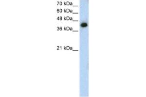 Image no. 1 for anti-Microtubule Associated Tumor Suppressor 1 (MTUS1) antibody (ABIN2462816)