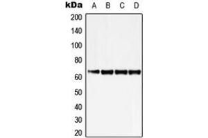 Western blot analysis of ZNF460 expression in K562 (A), Jurkat (B), SP2/0 (C), H9C2 (D) whole cell lysates.