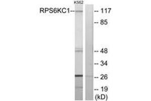 Western blot analysis of extracts from K562 cells, using RPS6KC1 Antibody.