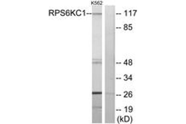 anti-Ribosomal Protein S6 Kinase, 52kDa, Polypeptide 1 (RPS6KC1) (AA 231-280) antibody