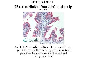 Image no. 1 for anti-CUB Domain Containing Protein 1 (CDCP1) (Extracellular Domain) antibody (ABIN1732916)