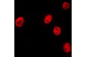 Image no. 1 for anti-Polymerase (RNA) II (DNA Directed) Polypeptide J, 13.3kDa (POLR2J) (N-Term) antibody (ABIN6258465)