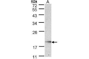 Image no. 2 for anti-Ubiquitin-Conjugating Enzyme E2G 2 (UBE2G2) (full length) antibody (ABIN2856659)