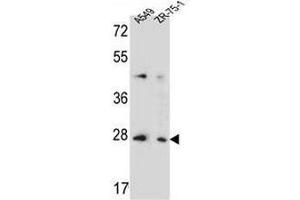 TM4SF4 anticorps  (N-Term)