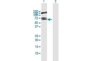 Image no. 2 for anti-Ring Finger Protein, LIM Domain Interacting (RLIM) (AA 1-624) antibody (ABIN949287)