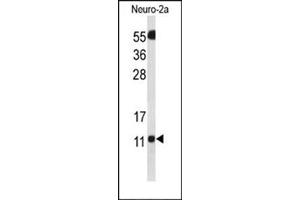 Image no. 2 for anti-SH3 Domain Binding Glutamic Acid-Rich Protein Like 3 (SH3BGRL3) (AA 31-60), (Middle Region) antibody (ABIN954790)