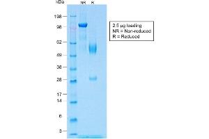 Image no. 1 for anti-Wilms Tumor 1 (WT1) antibody (ABIN6940905)