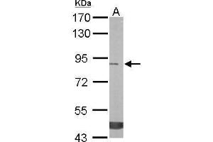 Image no. 3 for anti-Trehalase (Brush-Border Membrane Glycoprotein) (TREH) (Center) antibody (ABIN2856723)