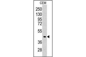 Image no. 2 for anti-Aldolase C, Fructose-Bisphosphate (ALDOC) (C-Term) antibody (ABIN615168)
