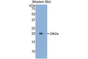 Image no. 1 for anti-Acid Phosphatase 1, Soluble (ACP1) (AA 1-158) antibody (ABIN1077730)