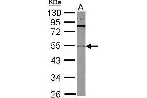 Image no. 4 for anti-Tubulin, beta 2A (TUBB2A) (Center) antibody (ABIN2857071)