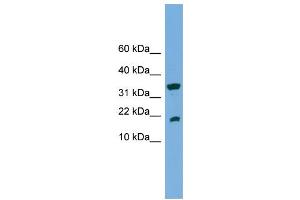 Image no. 2 for anti-Acid Phosphatase 1, Soluble (ACP1) (Middle Region) antibody (ABIN2775360)