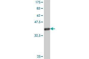 anti-Myotubularin Related Protein 12 (MTMR12) (AA 648-747) antibody