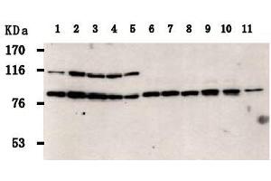 Image no. 2 for anti-PRP3 Pre-mRNA Processing Factor 3 Homolog (PRPF3) antibody (ABIN1449201)