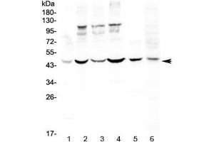Image no. 1 for anti-CD209 (CD209) antibody (ABIN5647543)
