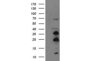 Image no. 3 for anti-Synovial Sarcoma, X Breakpoint 1 (SSX1) antibody (ABIN1501157)