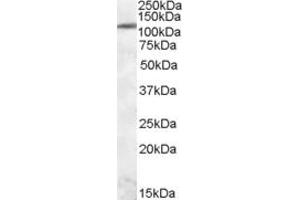 Image no. 2 for anti-Endoplasmic Reticulum To Nucleus Signaling 1 (ERN1) (Internal Region) antibody (ABIN308413)