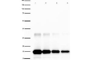 Image no. 2 for anti-Interleukin 2 (IL2) antibody (HRP) (ABIN964771)