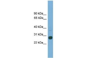 Image no. 1 for anti-MAX Dimerization Protein 1 (MXD1) (C-Term) antibody (ABIN2779954)