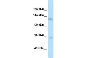 Image no. 1 for anti-tau Tubulin Kinase 2 (TTBK2) (N-Term) antibody (ABIN2775942)