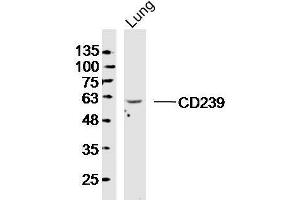 Image no. 1 for anti-Basal Cell Adhesion Molecule (Lutheran Blood Group) (BCAM) (AA 201-300) antibody (ABIN873081)
