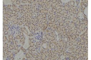 Image no. 2 for anti-Solute Carrier Family 16, Member 1 (Monocarboxylic Acid Transporter 1) (SLC16A1) (pSer213) antibody (ABIN6269505)