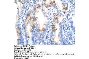Image no. 2 for anti-TEA Domain Family Member 3 (TEAD3) (C-Term) antibody (ABIN2780493)