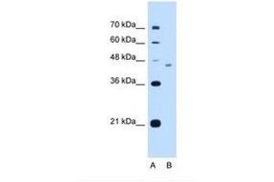 Image no. 1 for anti-FIC Domain Containing (FICD) (AA 351-400) antibody (ABIN321159)