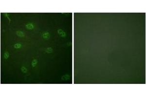 Image no. 2 for anti-GATA Binding Protein 4 (GATA4) (AA 71-120) antibody (ABIN1532617)